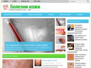 Скриншот главной страницы сайта boleznikogi.com